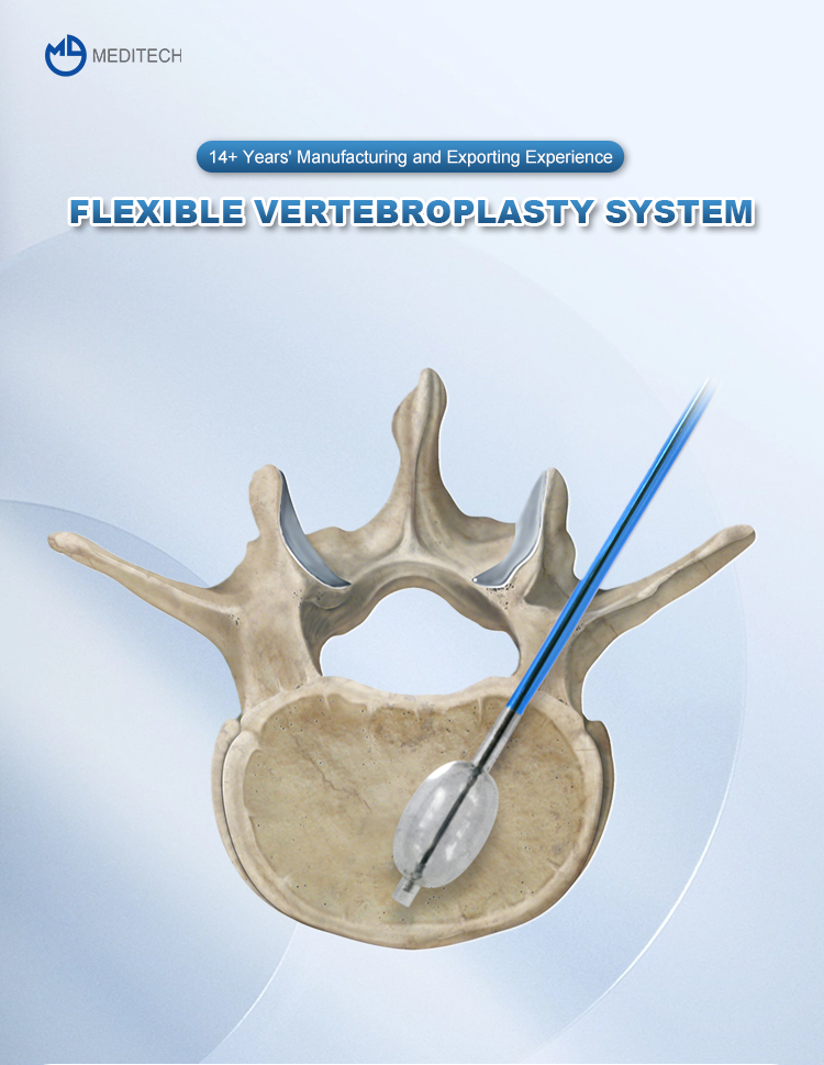 Костный цемент