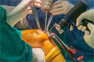 Осциллирующая пила