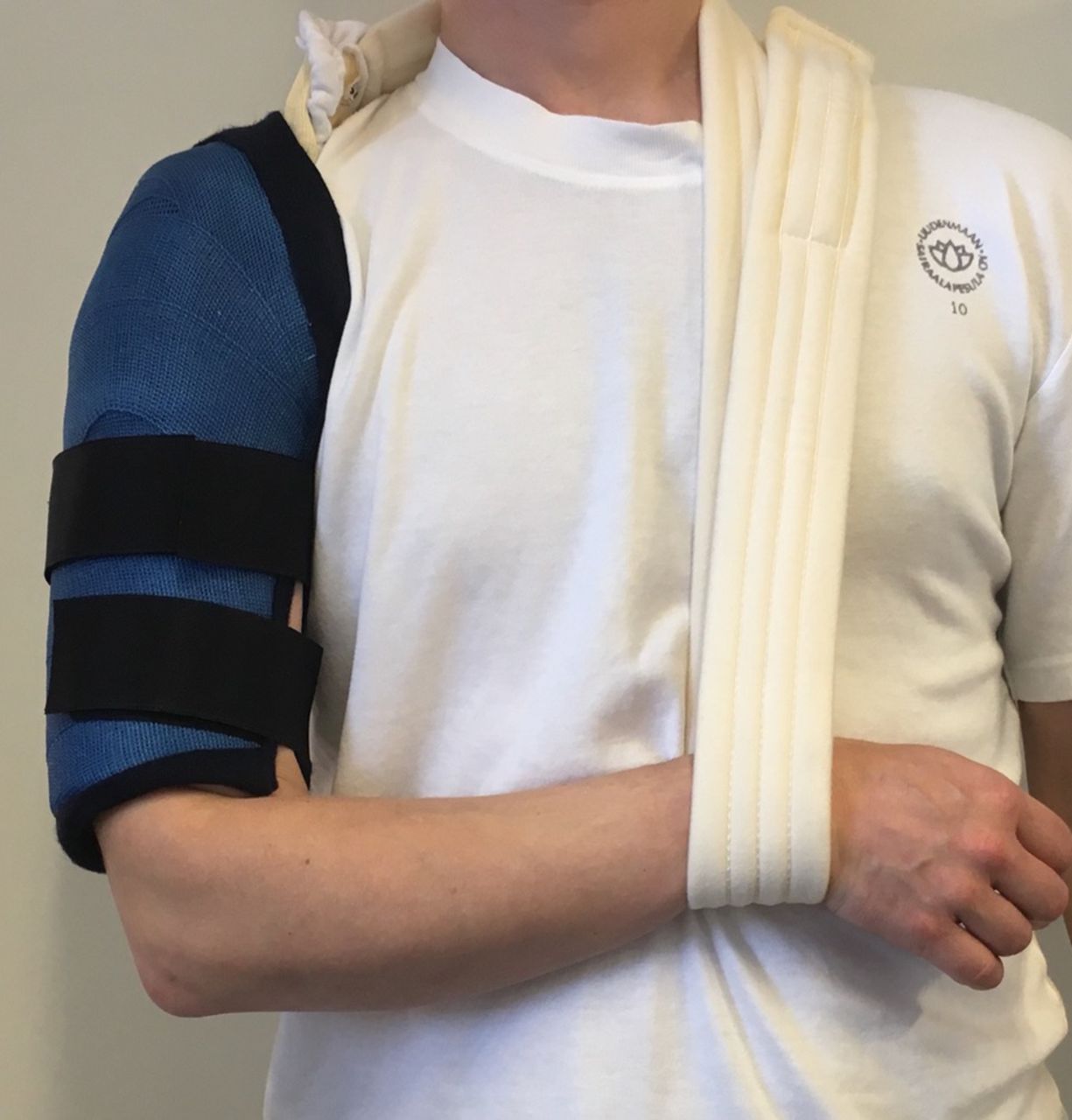 Проксимальная фиксирующая пластина плечевой кости