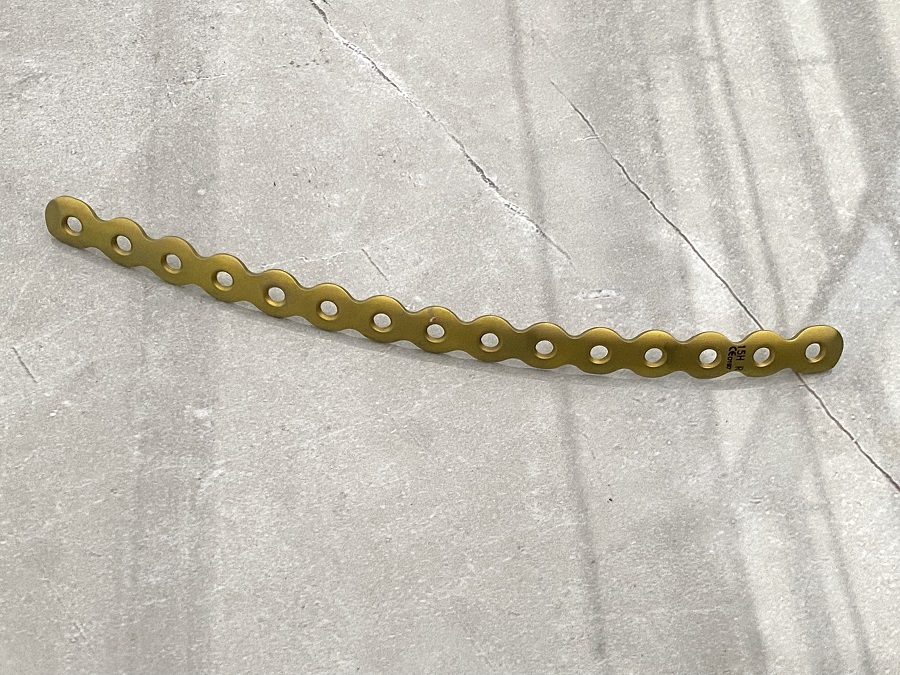 Фиксирующая пластина для реконструкции ребер