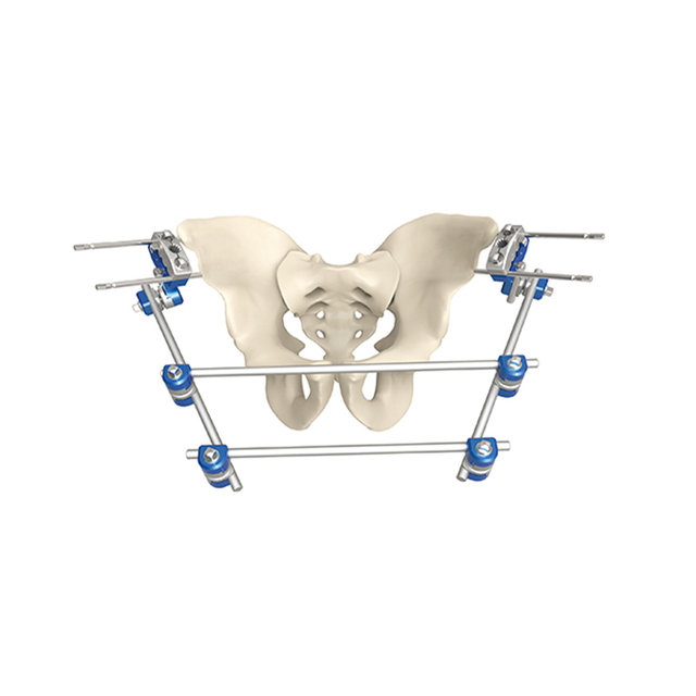 Внешний фиксатор таза