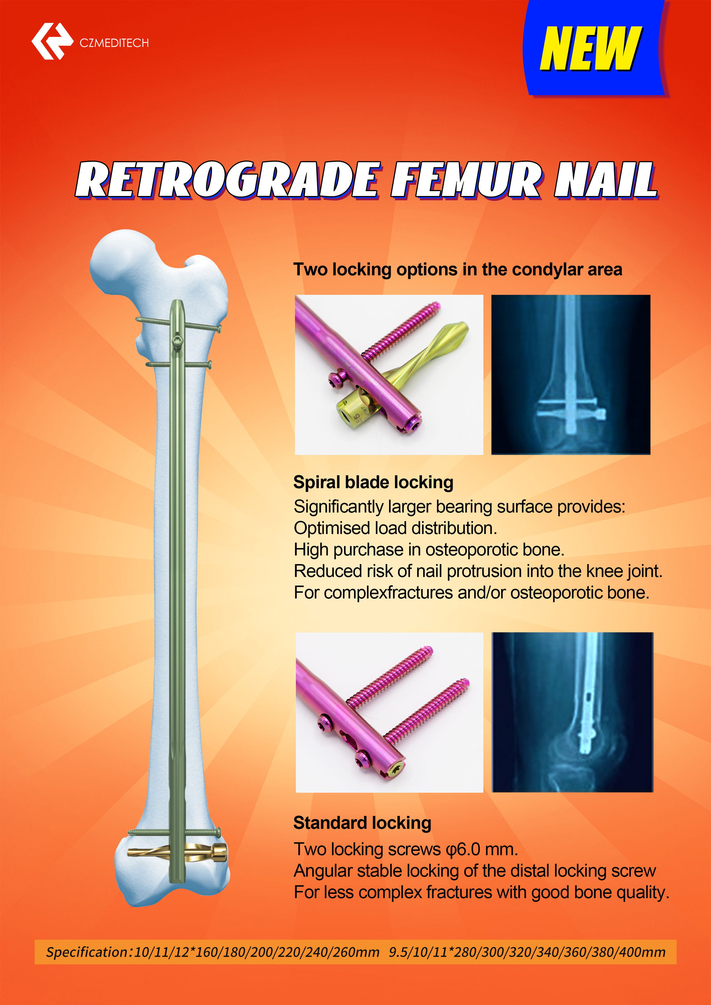 DFN Intramedullary Nail Box 1000-0135