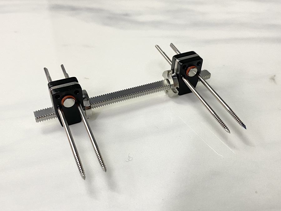 Внешний фиксатор мини-фрагмента