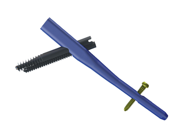 Интрамедуллярный гвоздь