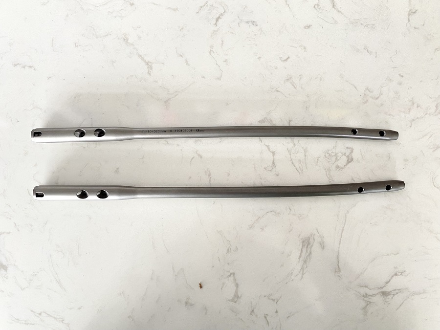 Реконструкция бедренной кости интрамедуально гвоздем