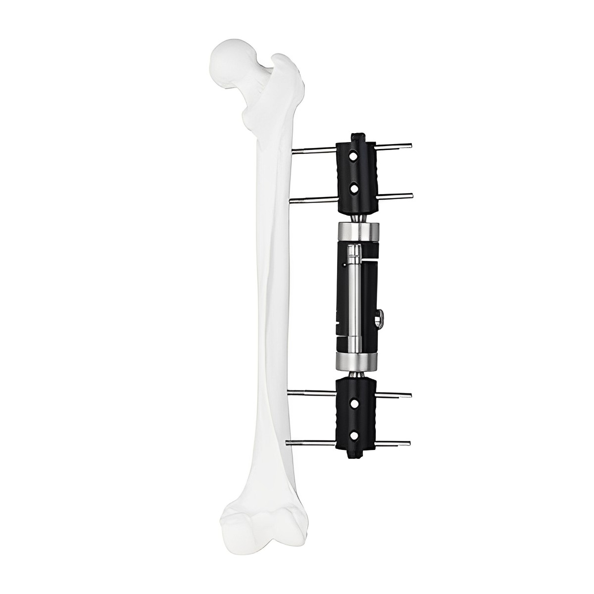 Динамический мультиаксиальный фиксатор