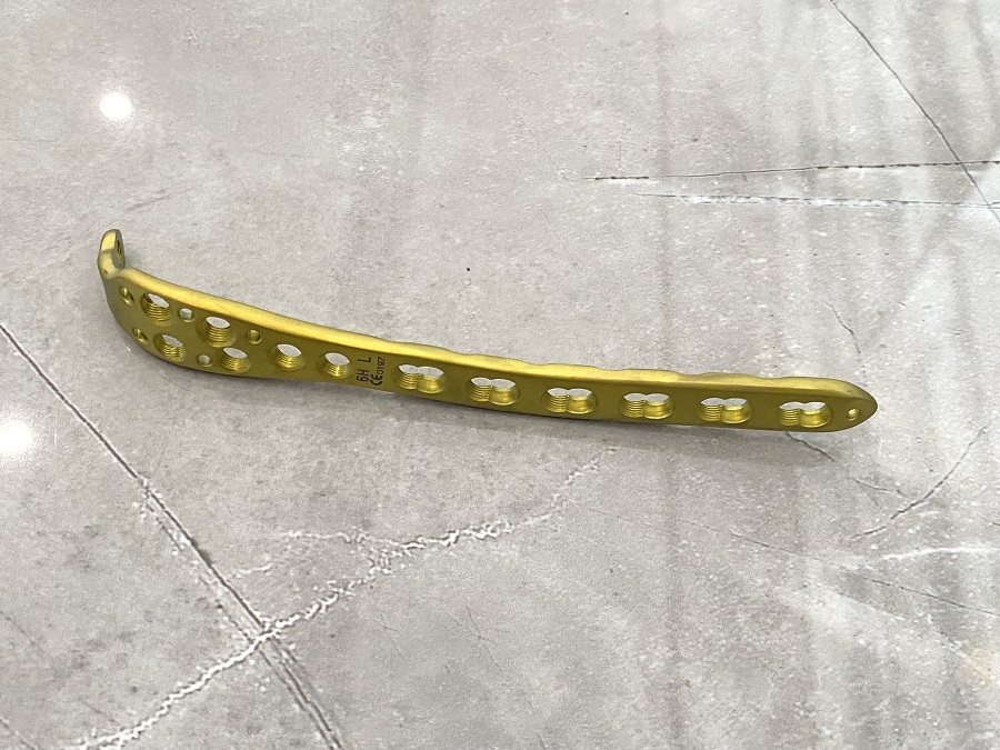 Фиксирующая пластина локтевого отростка