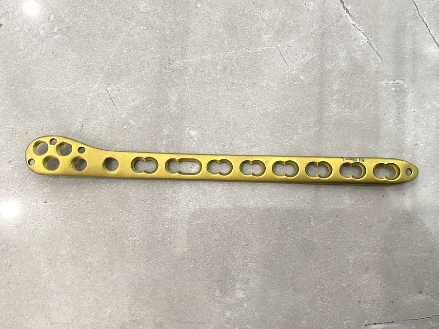 Дистальная малоберцовая стопорная пластина