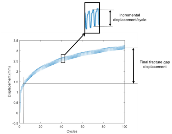 Перелом надколенника