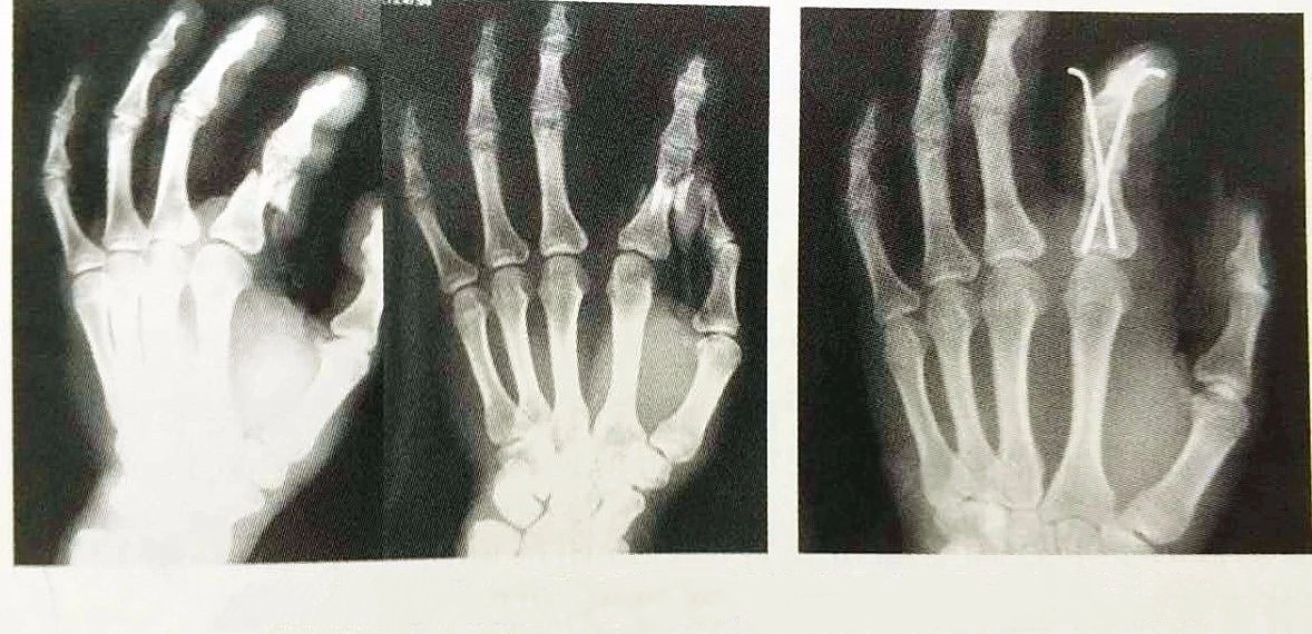 Клиника игла