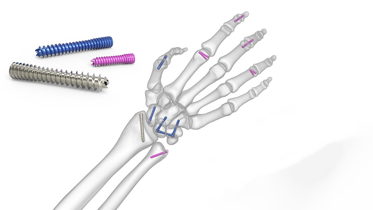 Миниатюрные винты