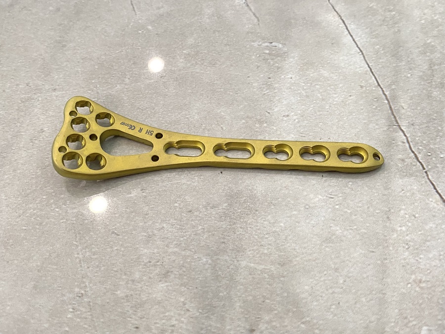 Фиксирующая пластина VA дистального отдела лучевой кости