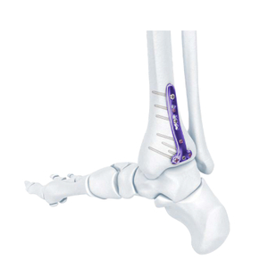 VA Distal Bipia Bocking T-Plate