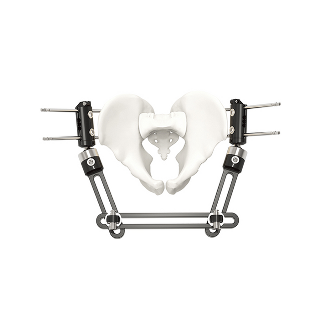 Внешний фиксатор фрагмента таза - тип A