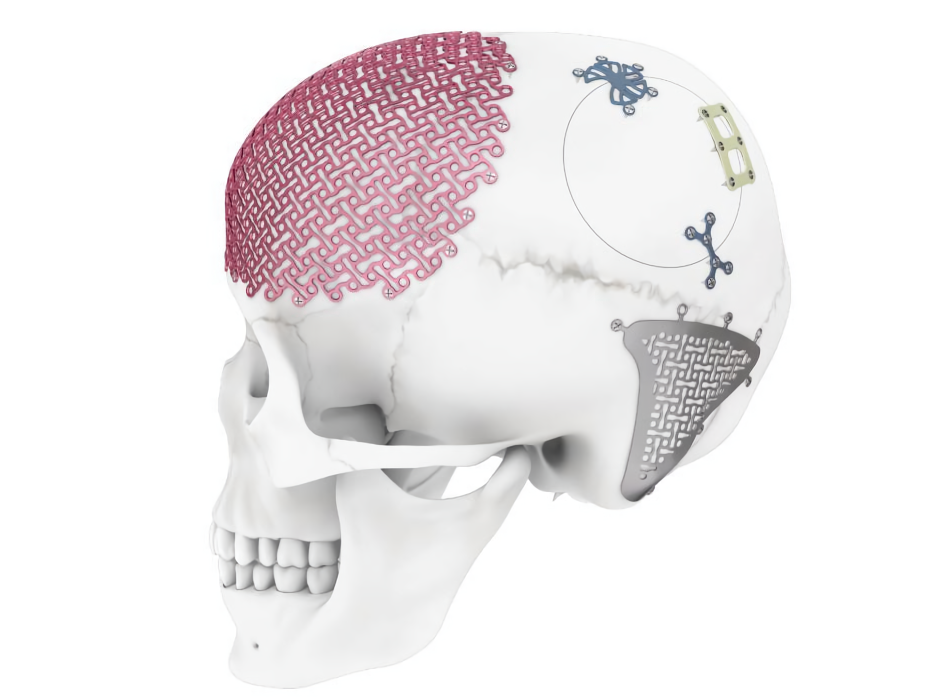 Что такое CMF/челюстно-лицевой?