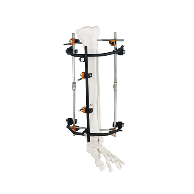 Половина кольца внешний фиксатор