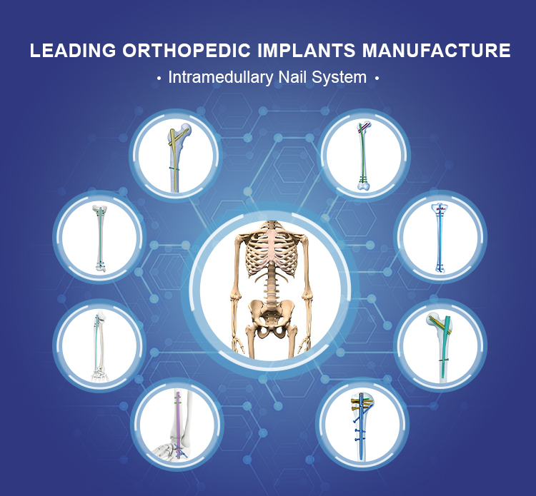 Эксперт Р/Афн.Ретроградный/антеградный бедренный гвоздь