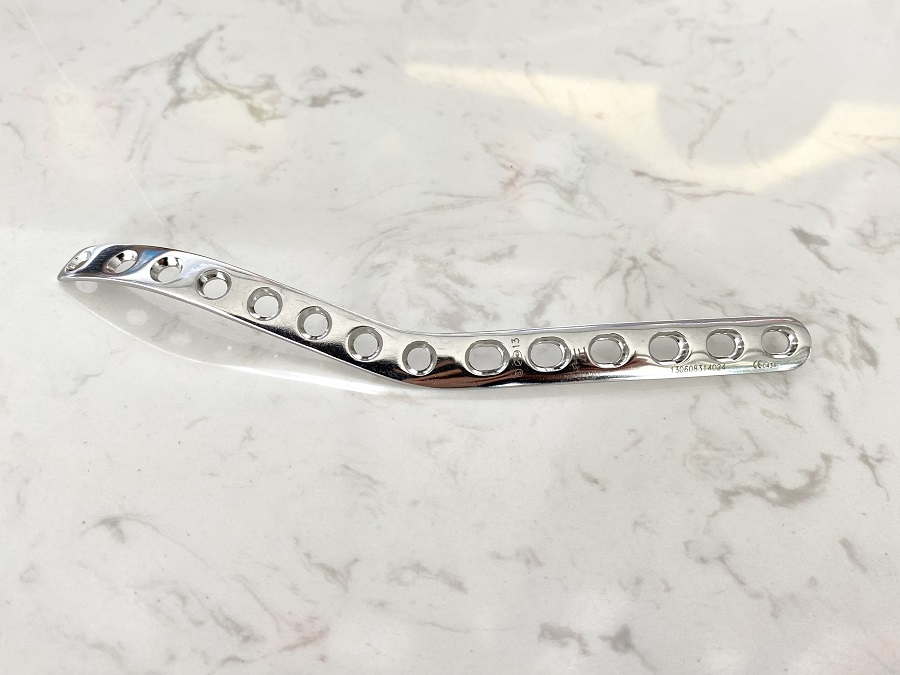 Дистальная плечевая боковая пластина (тип локтевого отростка)