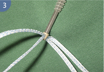 Полиэтиленовый шовный материал