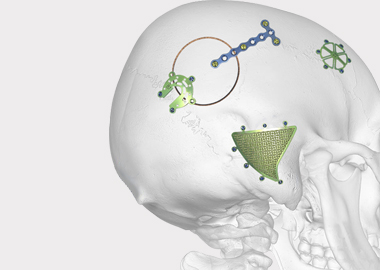 Нейроистская система