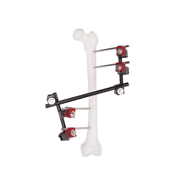 Универсальный штифт/стержень до сцепления