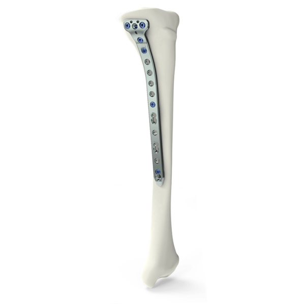 Блокирующая пластина для проксимальной медиальной большеберцовой остеотомии