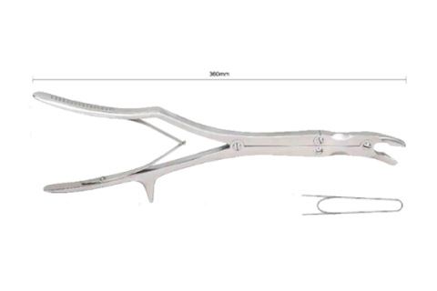 Ультрадлинный локтевой отросток