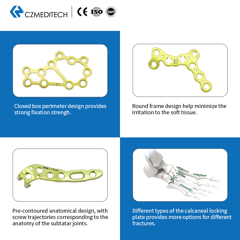 Запирающая пластина