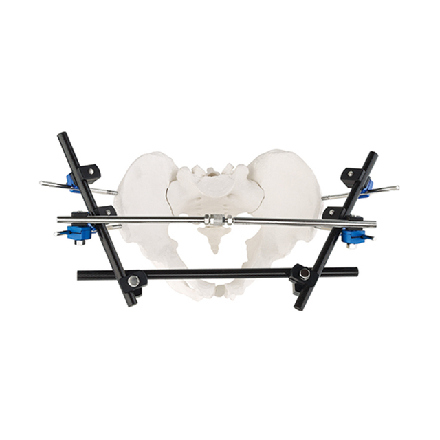 Внешний фиксатор таза.