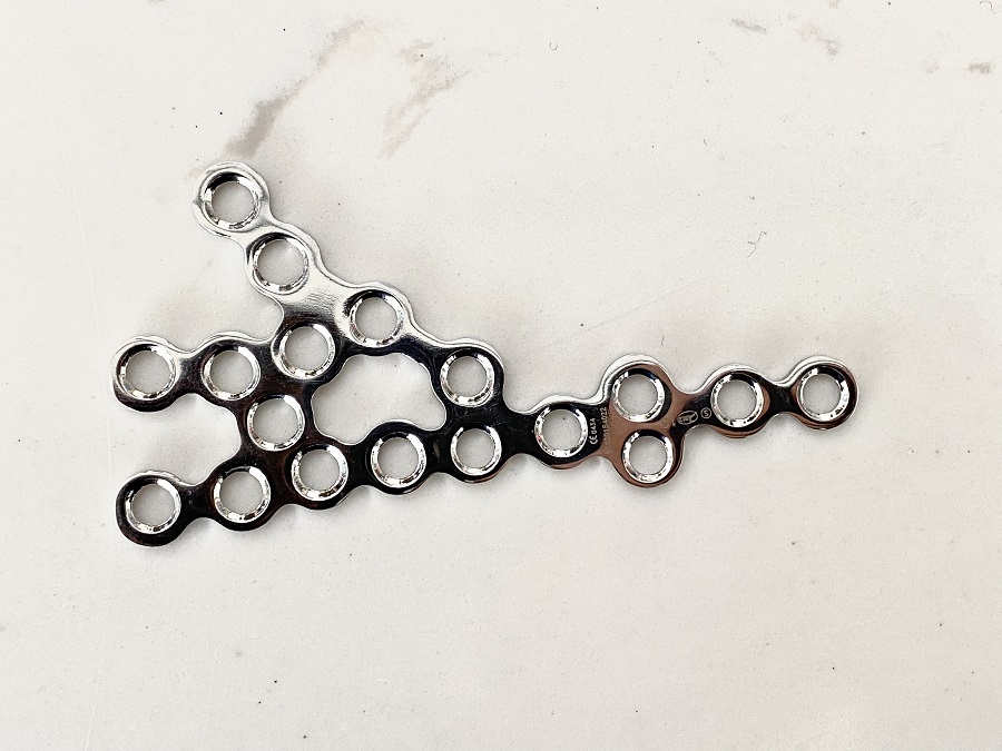 Пластина пяточной кости-IV