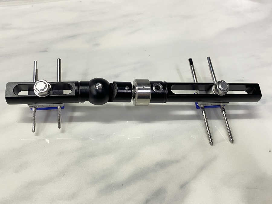 Внешний фиксатор лучезапястных суставов