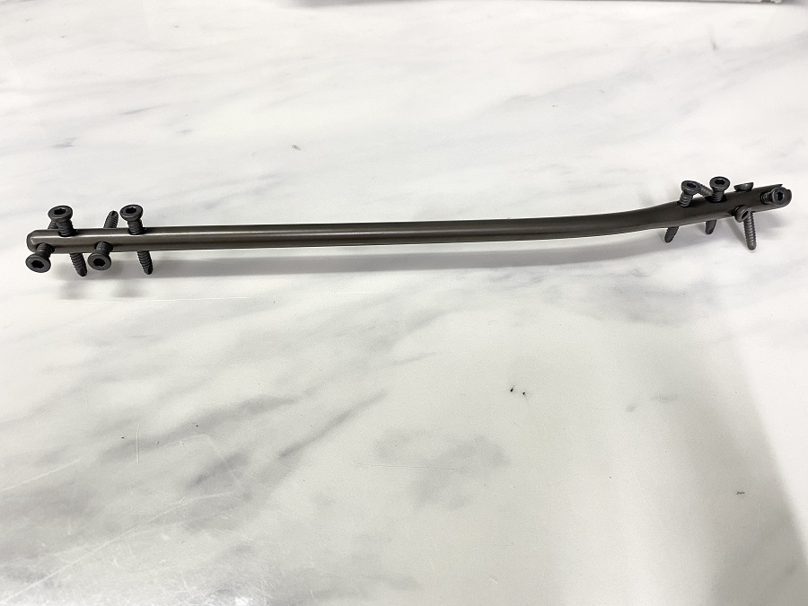 Эксперт большеберцовой кости