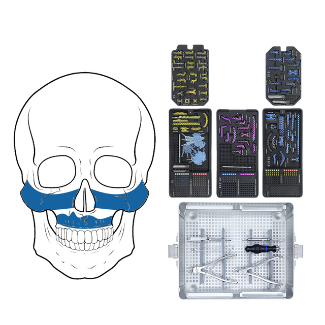 1,5 мм 2,0 мм блокировка челюстной лицевой системы