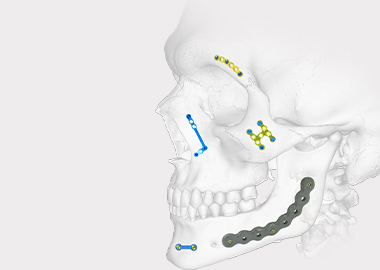 Система покрытия нижней челюсти