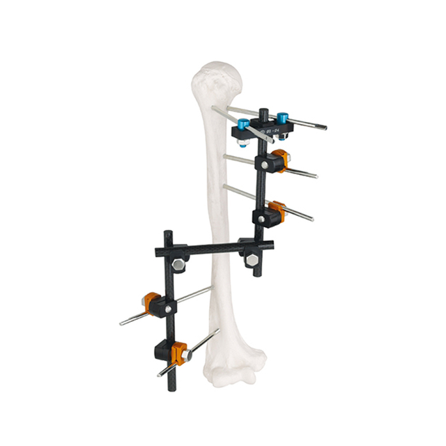 Z -кадр (тип t) Внешний фиксатор