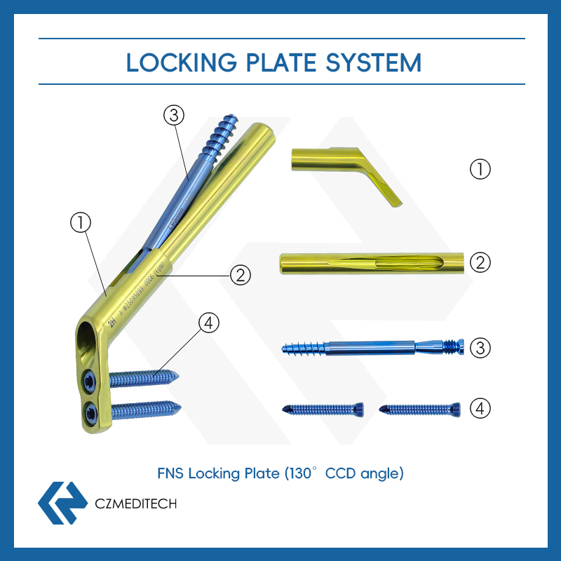 FNS (система шейки бедренной кости)