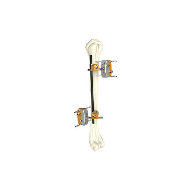 Внешний фиксатор плечевого вала