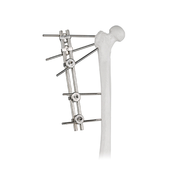 Двойной стержень внешний фиксатор