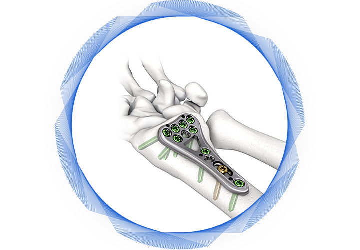 Стопорная шайба