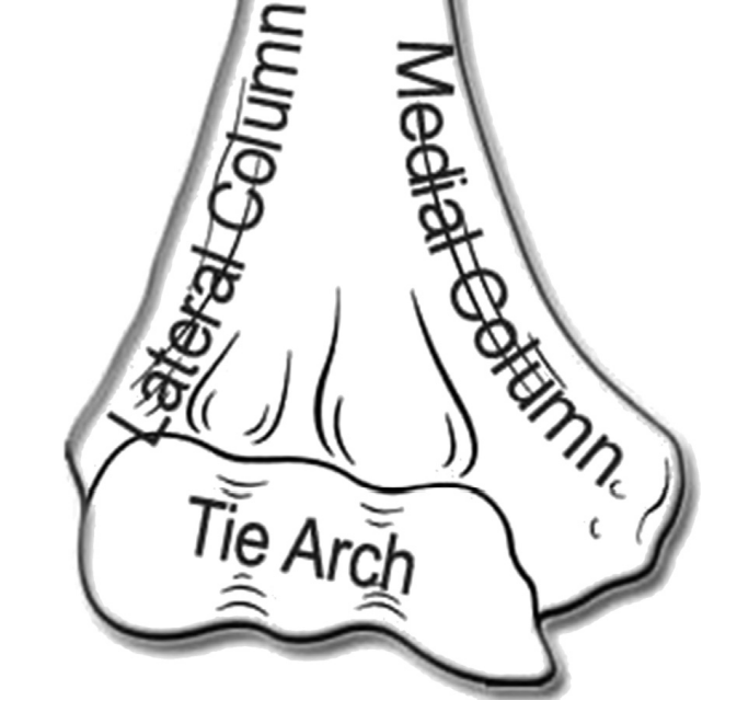 Перелом дистального отдела плечевой кости
