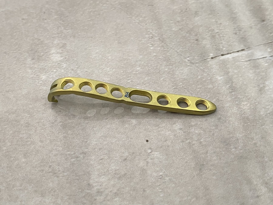 Дистальная локтевая фиксирующая пластина