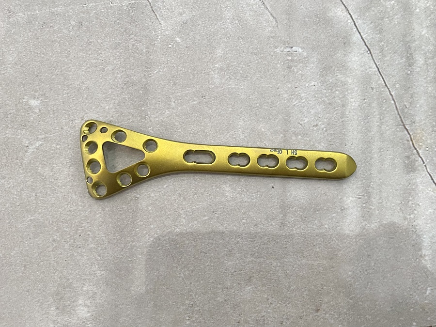 Дистальная стопорная пластина дорсальной радиальной дельты