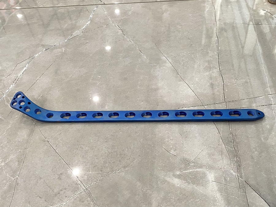 Боковая стопорная пластина большеберцовой головки