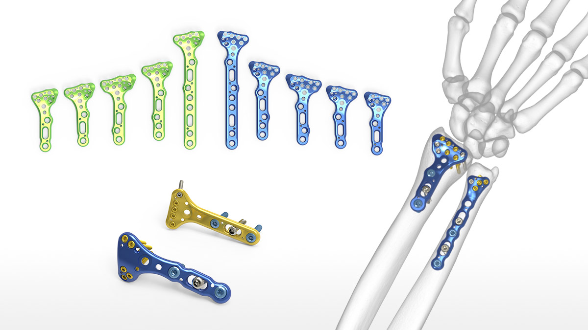 Стопорная шайба