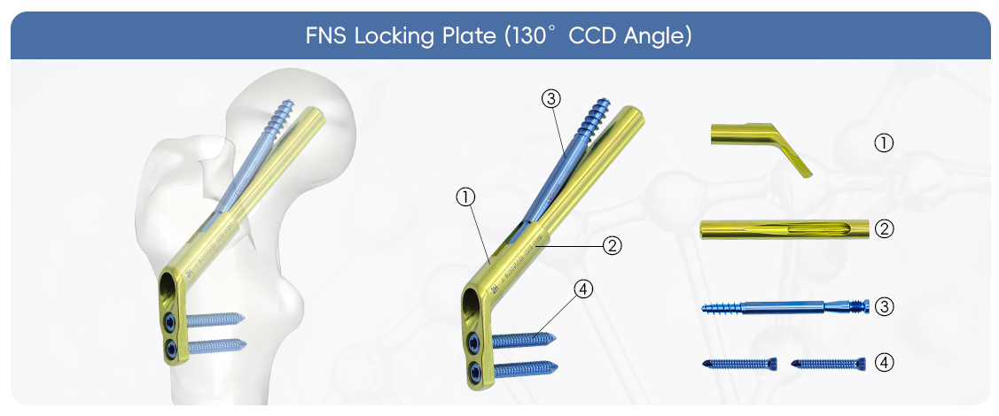 czmeditech-fns-бедренная-шейная-система-фиксация перелома бедра