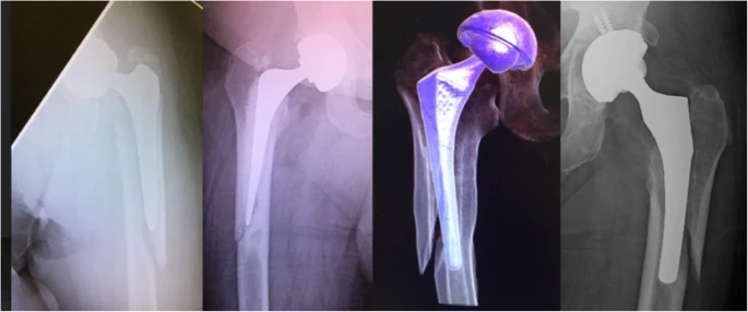 Режим обратного флип-брейка.