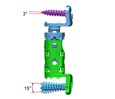 Спинальная хирургия Cage-4