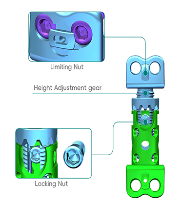 Спинальная хирургия Cage-1