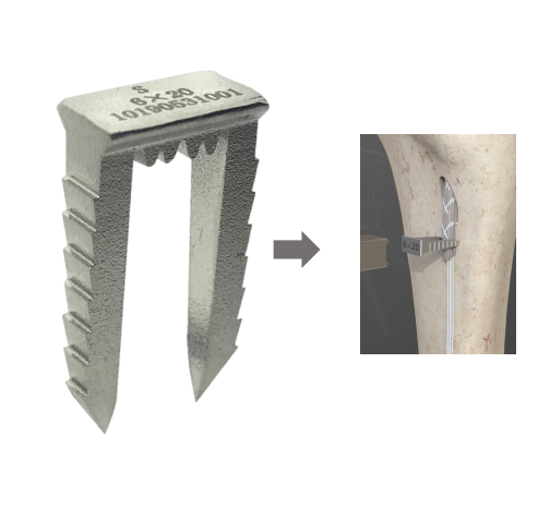 Скоба для связок