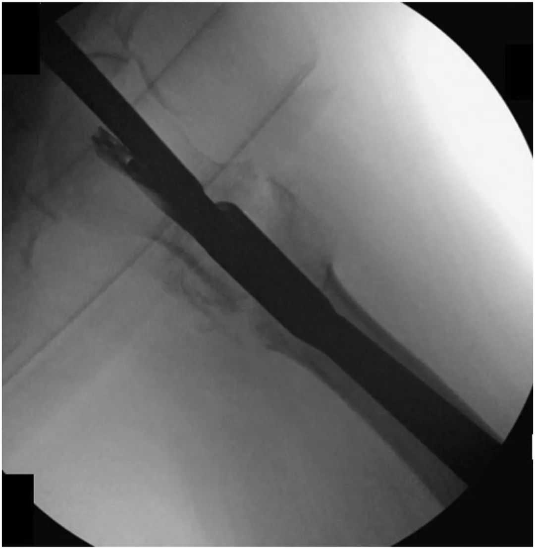 Установочный винт